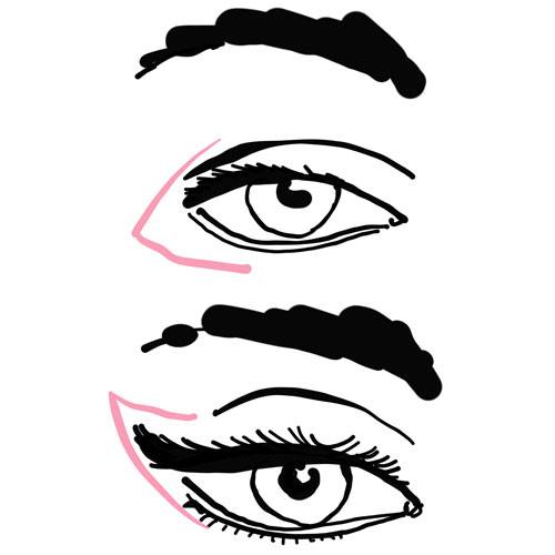 La cantoplastica e la modifica della forma degli occhi