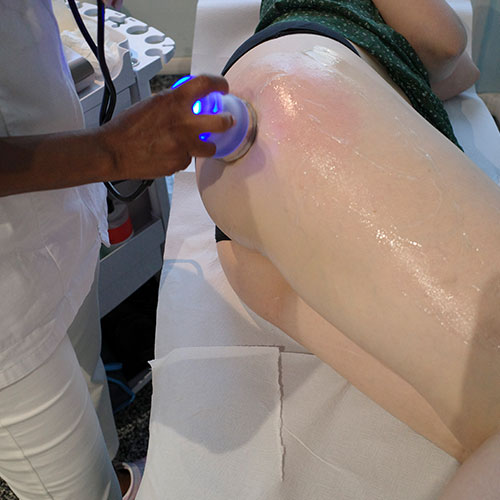 Cavitazione Medica a Milano