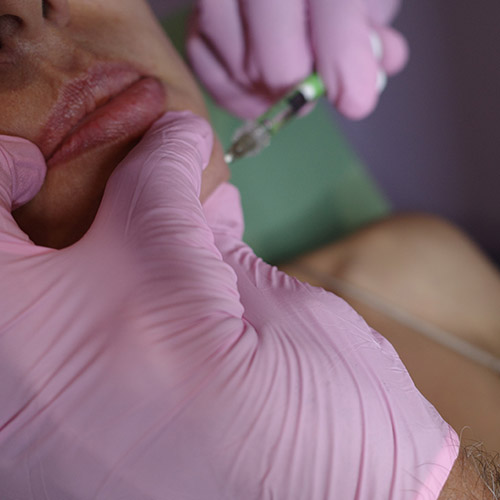 Iniezioni di Botox a Milano