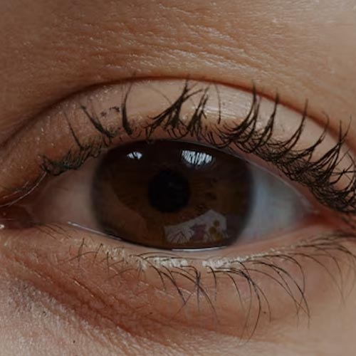 La ptosi palpebrale e lo sguardo vecchio e stanco