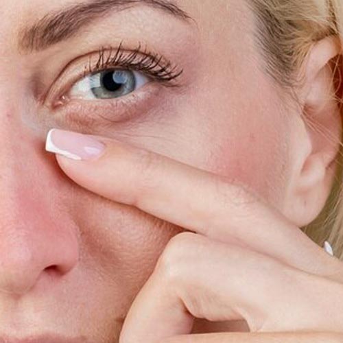 La ptosi palpebrale e lo sguardo vecchio e stanco